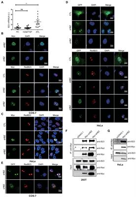 A newly identified interaction between nucleolar NPM1/B23 and the HTLV-I basic leucine zipper factor in HTLV-1 infected cells